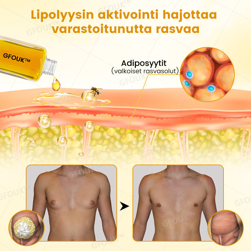 💪🏻GFOUK™ ThermoFirm Mehiläismyrkky Gynekomastiaöljy