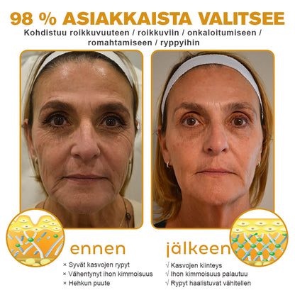 (💍Valmistettu ja lähetetty Kanadasta✅) 👩‍⚕️Furzero™ Botox-mehiläisen myrkkyrynkojenpoisto-kreemiksi - (VIIMEINEN PÄIVÄ 70% ALENNUSTA)