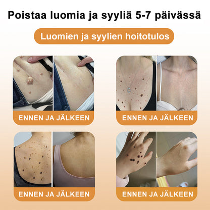 🍍Turonu™ Be Venom Treatment -voide (Viimeinen päivä, 80 % alennus)