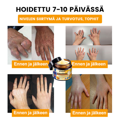 🪸🐧Ourlyard™ Mehiläismyrkky Luonnollinen Terapeuttinen Kipuvoide Ultra-Vahva ja Välitön Vaikutus