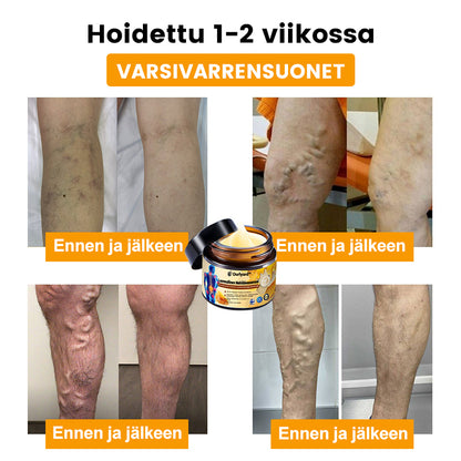 🪸🐧Ourlyard™ Mehiläismyrkky Luonnollinen Terapeuttinen Kipuvoide Ultra-Vahva ja Välitön Vaikutus