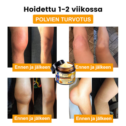 🪸🐧Ourlyard™ Mehiläismyrkky Luonnollinen Terapeuttinen Kipuvoide Ultra-Vahva ja Välitön Vaikutus