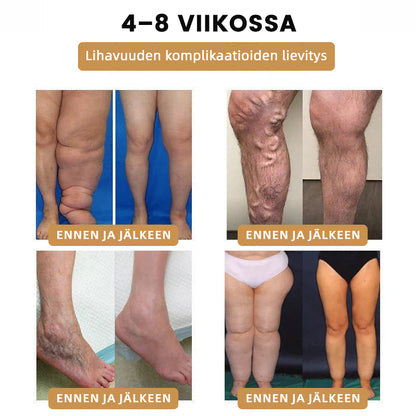 🛎️🍹2024 🆕 Futusly™ Ultraääninen Rasvanräjäyttävä ja Detoksifioiva Ranneke - Energian Tasapaino ⏱️ (Viimeinen päivä 80 % alennus + Lääkärien suosittelema) ⌚⌚