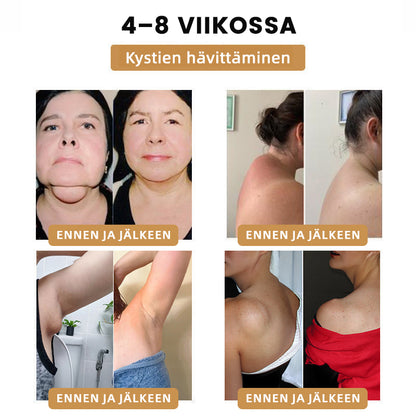 🛎️🍹2024 🆕 Futusly™ Ultraääninen Rasvanräjäyttävä ja Detoksifioiva Ranneke - Energian Tasapaino ⏱️ (Viimeinen päivä 80 % alennus + Lääkärien suosittelema) ⌚⌚