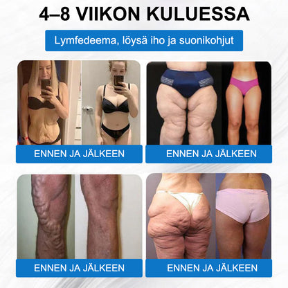 👕【Viimeisen päivän tarjous -60 %🌟】🌈🌈ZVOEVO® SMGT-GLP-1 𝐓𝐢𝐫𝐳𝐞𝐧𝐬𝐭𝐢 & Kollageeni Nano-Mikroneula Laihdutuslaastari丨Kohdistuu lihavuuteen, löysään ihoon, verenpaineeseen, diabetekseen, rasvamaksaan, nivelkipuihin ja väsymykseen