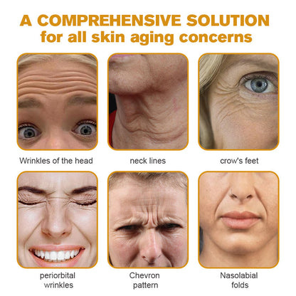 (💽Made and Shipped from Canada✅) 👩‍⚕️Furzero™ Botox Bee Venom Wrinkle Removal Cream-(LAST DAY 70% OFF)