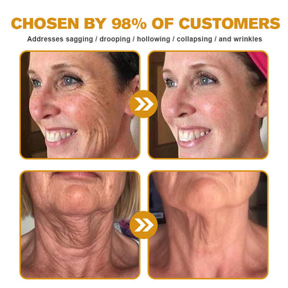 (🍁Made and Shipped from Canada✅) 👩‍⚕️Furzero™ Botox Bee Venom Wrinkle Removal Cream-(LAST DAY 70% OFF)