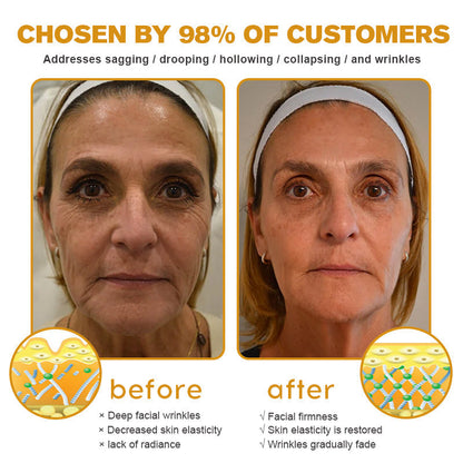 (👽Made and Shipped from Canada✅) 👩‍⚕️Furzero™ Botox Bee Venom Wrinkle Removal Cream-(LAST DAY 70% OFF)